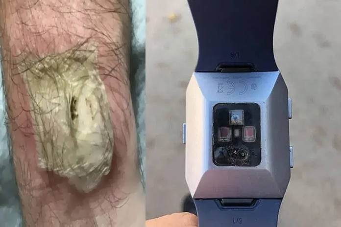Fitbit Fitness Band Blast