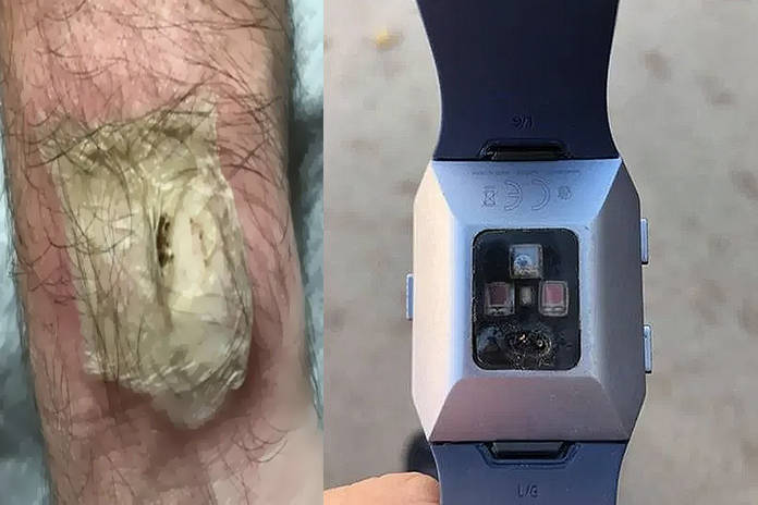 https://static.hub.91mobiles.com/multisite/wp-content/uploads/sites/7/2019/11/Fitbit-Band-Blast.jpg