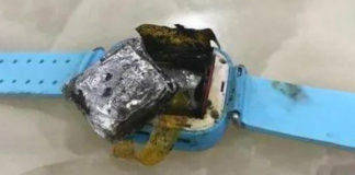 कलाई में पहने हुए अचानक फटी Smartwatch की बैटरी, वॉच के उड़े परखच्चे, बाल-बाल बची यूजर जान